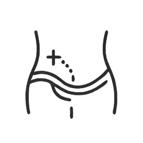 疝氣與腹壁修補手術